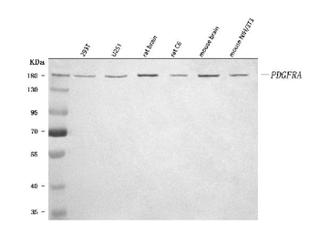 PDGFRA Rabbit Polyclonal Antibody