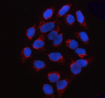 SSBP1 Rabbit Polyclonal Antibody