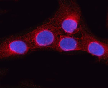 OSBPL9 Rabbit Polyclonal Antibody