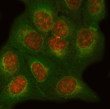 ONECUT1 Rabbit Polyclonal Antibody