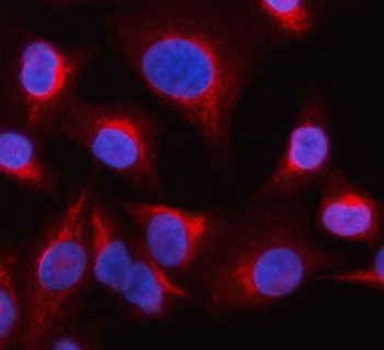 OCRL Rabbit Polyclonal Antibody
