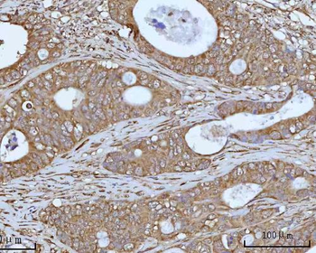 OCRL Rabbit Polyclonal Antibody