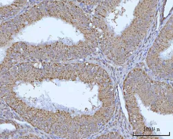 OCRL Rabbit Polyclonal Antibody