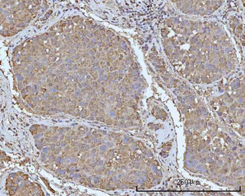 OCRL Rabbit Polyclonal Antibody