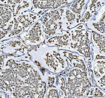 RTCB Antibody