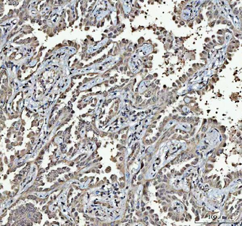 RTCB Antibody