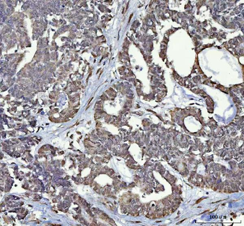 RTCB Antibody