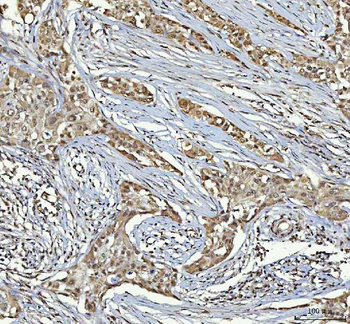 RTCB Antibody