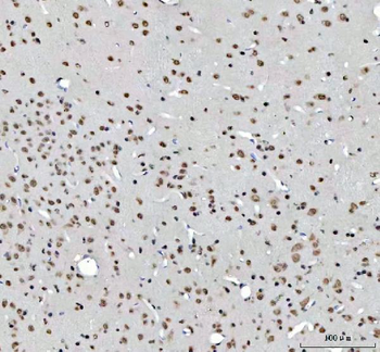 RTCB Antibody