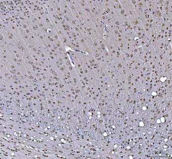 RTCB Antibody