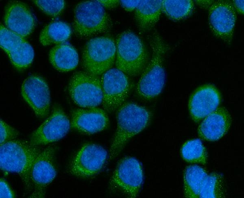 SCCPDH Rabbit Polyclonal Antibody