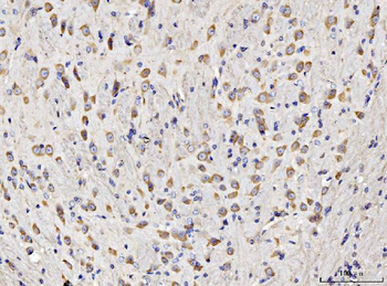 RPL11 Antibody