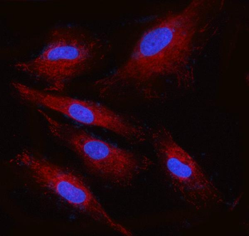 RPN2 Rabbit Polyclonal Antibody