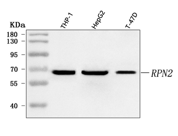 RPN2 Rabbit Polyclonal Antibody