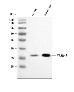 RLBP1 Rabbit Polyclonal Antibody