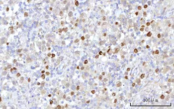 RRP7A Rabbit Polyclonal Antibody