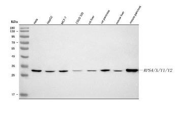 RPS4/X/Y1/Y2 Rabbit Polyclonal Antibody