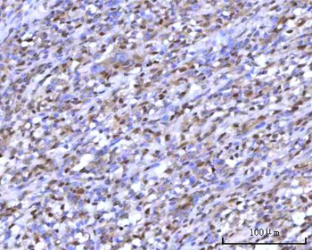 RNGTT Rabbit Polyclonal Antibody