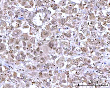 RNGTT Rabbit Polyclonal Antibody