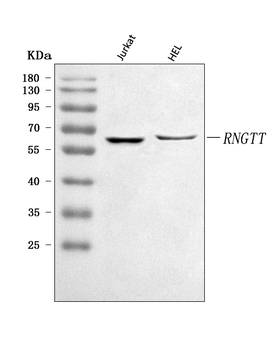 RNGTT Rabbit Polyclonal Antibody