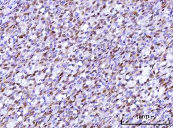 RFX1 Rabbit Polyclonal Antibody