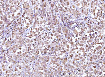 RFX1 Rabbit Polyclonal Antibody