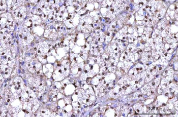 RNF34 Antibody