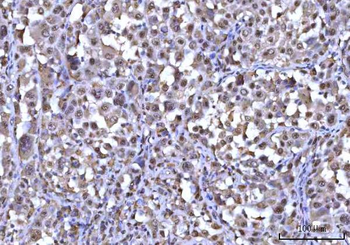 RNF34 Antibody