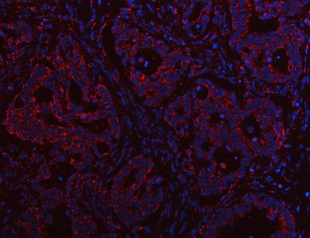 PTPIP51/RMDN3 Antibody