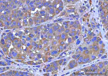 PTPIP51/RMDN3 Antibody
