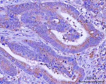 PTPIP51/RMDN3 Antibody