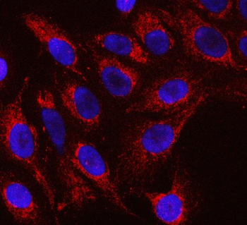 RFTN1 Antibody