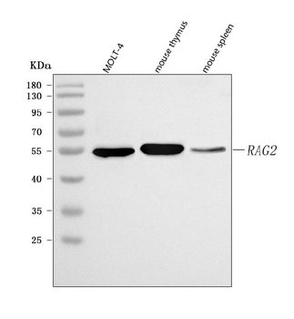 RAG2 Rabbit Polyclonal Antibody