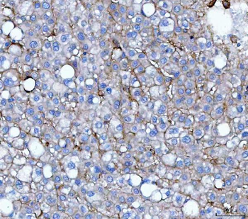 CD276 Antibody