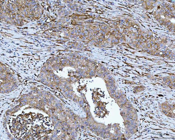 CD276 Antibody