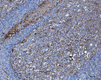 CD276 Antibody