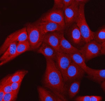 RANBP1 Rabbit Polyclonal Antibody