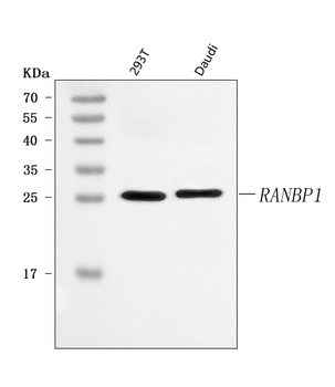 RANBP1 Rabbit Polyclonal Antibody