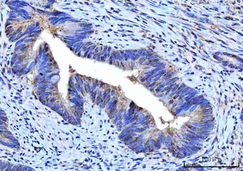 RPS5 Rabbit Polyclonal Antibody
