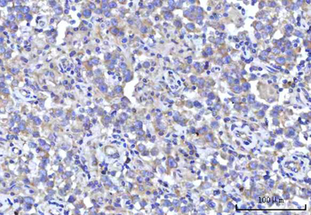 RPS5 Rabbit Polyclonal Antibody