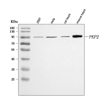 Plakophilin 2/PKP2 Rabbit Polyclonal Antibody