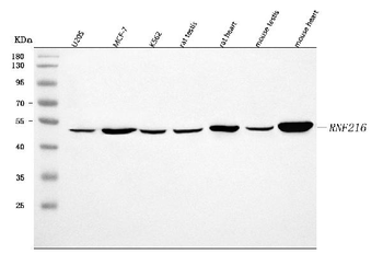 RNF216 Rabbit Polyclonal Antibody