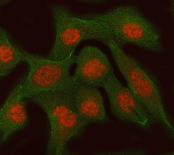 RFC3 Rabbit Polyclonal Antibody