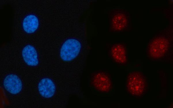 RFC2 Rabbit Polyclonal Antibody