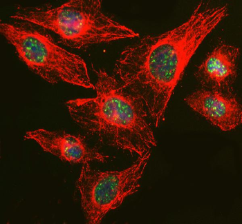 RBM25 Antibody
