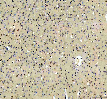 RBM25 Antibody