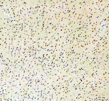 RBM25 Antibody