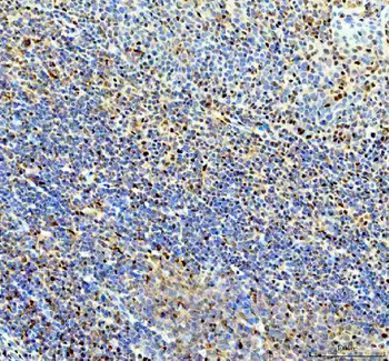 P15RS/RPRD1A Antibody