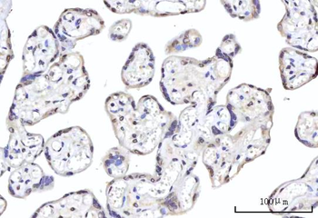 RBM22 Antibody