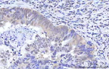 RBM22 Antibody
